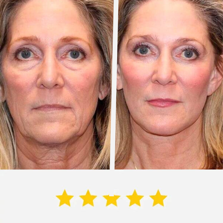 Illumina LED Face Mask